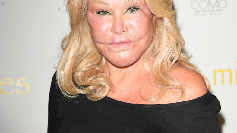 Jocelyn Wildenstein