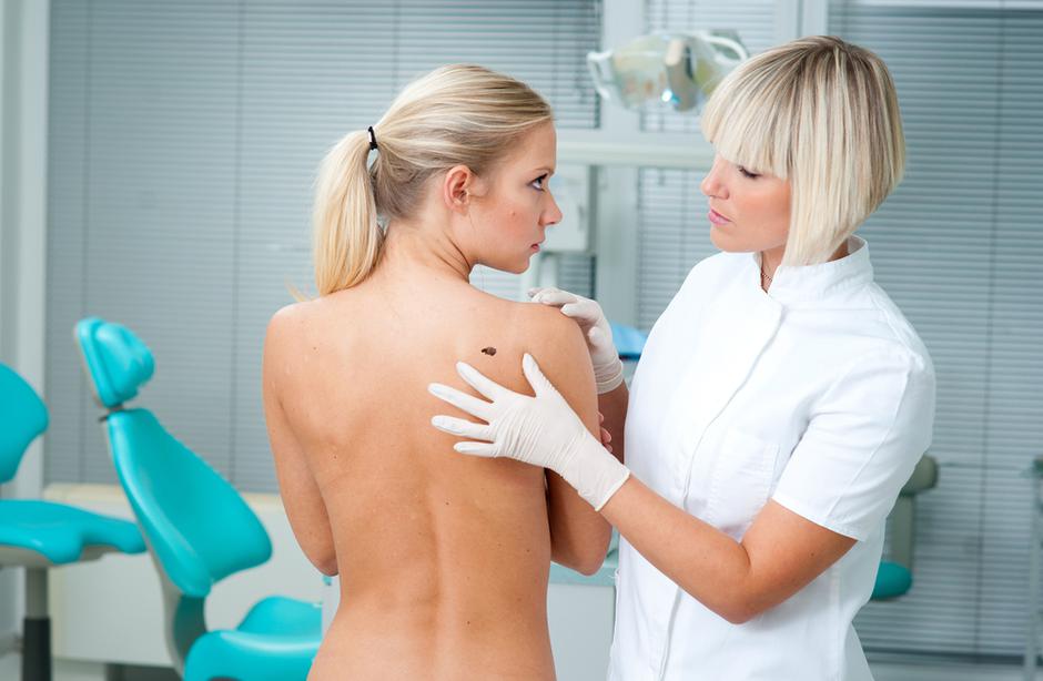 zdravnik pregled koža kožni rak | Avtor: Shutterstock