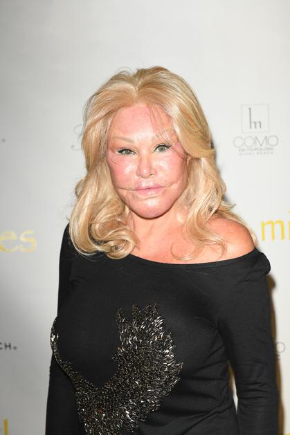 Jocelyn Wildenstein