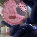 Američani so prepričani, da so superbakterijo vzgojili v laboratoriju in jo name
