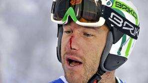 Bode Miller je v Leviju utrpel grd udarec kola v obraz. (Foto: Reuters)